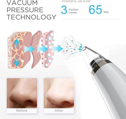 Vacuum Blackhead Remover Cleaner