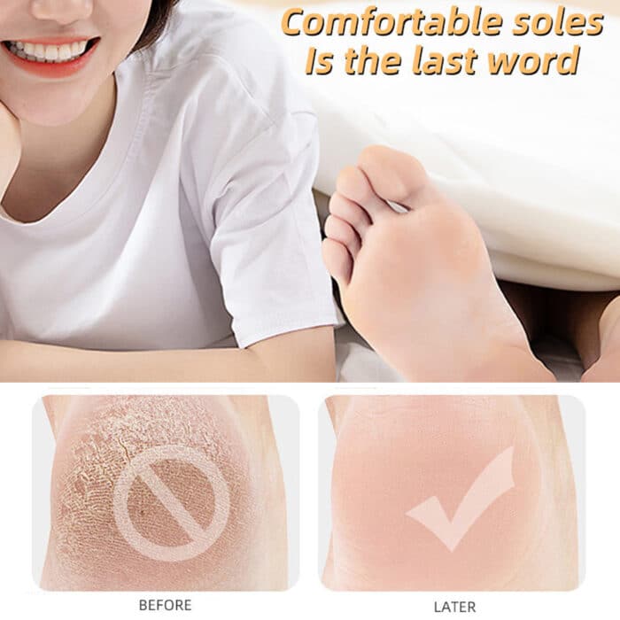 Moisturizing Anti-Crack Silicone Socks for heal cracks and pain relief