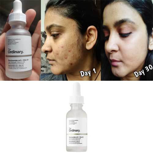 Ordinary Niacinamide 10% + Zinc 1% Serum