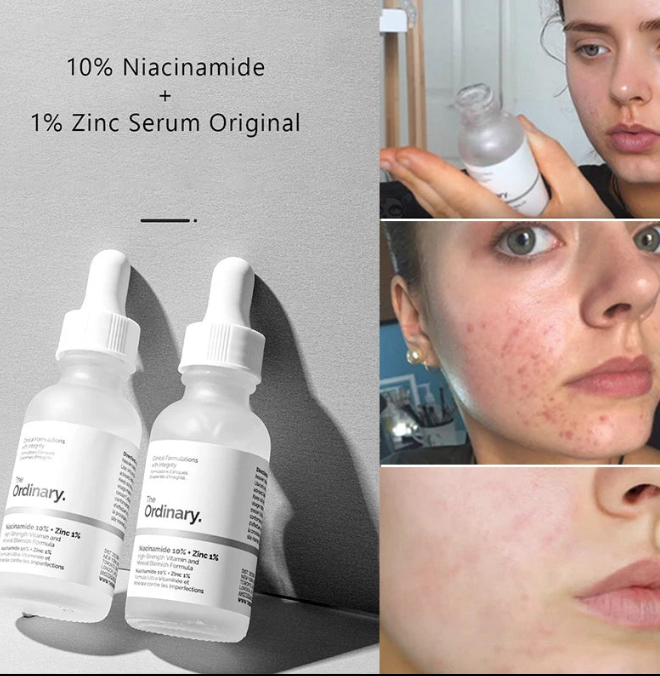 Ordinary Niacinamide 10% + Zinc 1% Serum